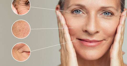 Fruit, Veggies & Skin Health - What's The Relationship?